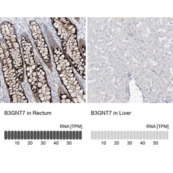 B3GNT7 Antibody, Novus Biologicals:Antibodies:Primary Antibodies